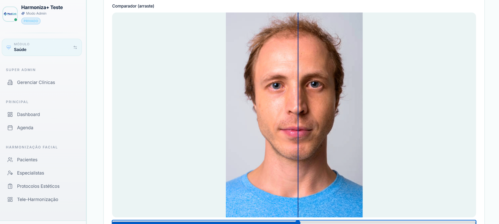 Comparador antes/depois