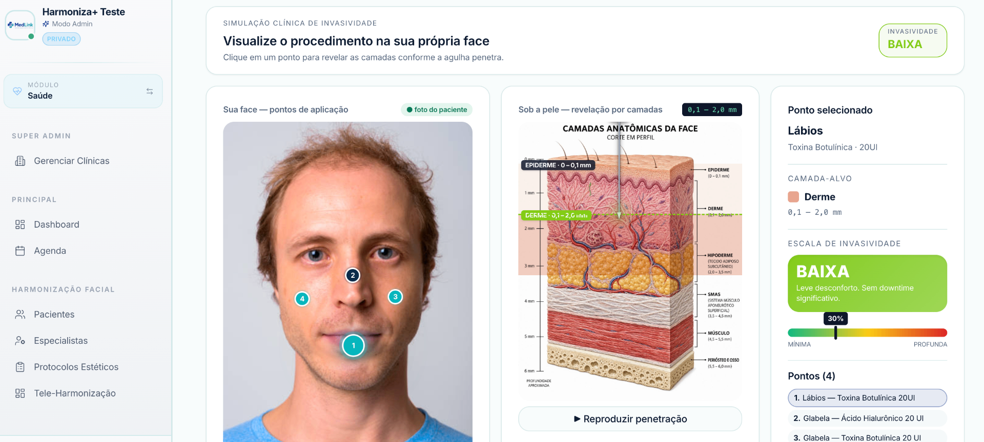 Simulação 3D de aplicação